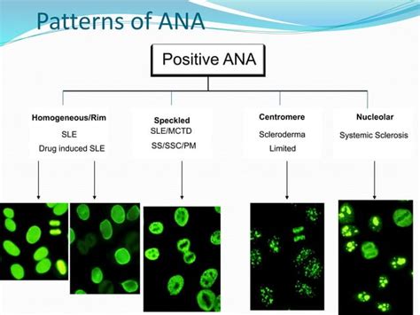 Anti Nuclear Antibody Ppt