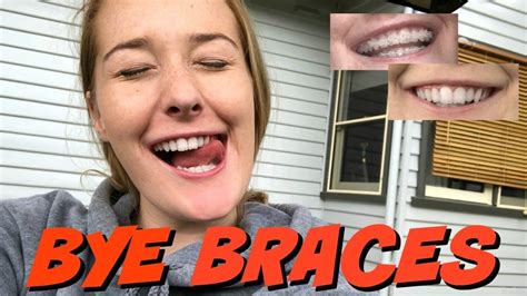 GETTING MY BRACES OFF VLOG 2018 YouTube