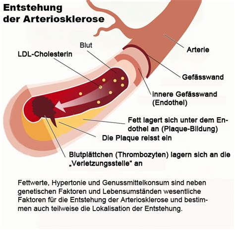 Diabetes Mellitus Praxis F R Allgemeinmedizin