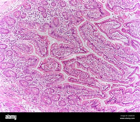 Stomach Tissue Light Micrograph Of A Section Through Glandular Mucosal