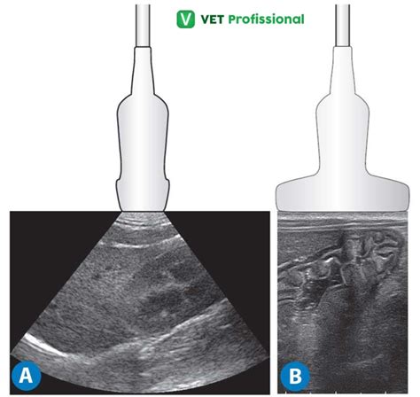 Tipos De Transdutores De Ultrassom Braincp