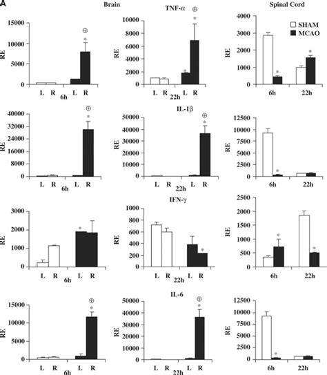 Effects Of Stroke On Expression Of Cytokines And Chemokines Receptors