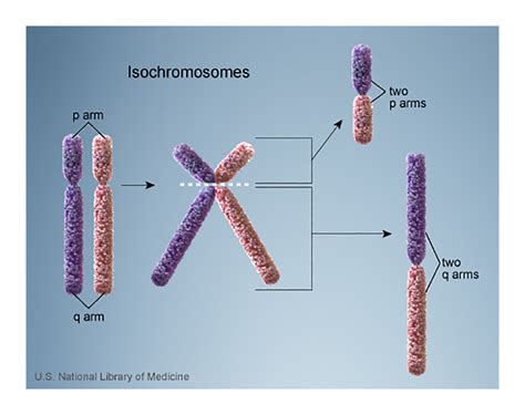 What Causes Pallister-Killian Mosaic Syndrome? - StoryMD