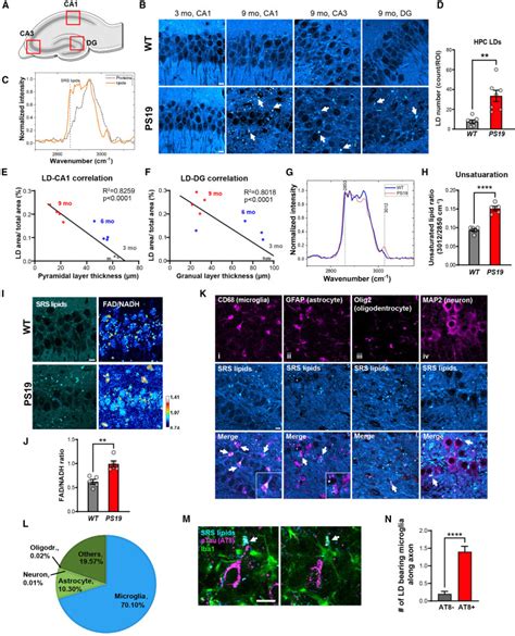 Microglial Lipid Droplet Accumulation In Tauopathy Brain Is Regulated