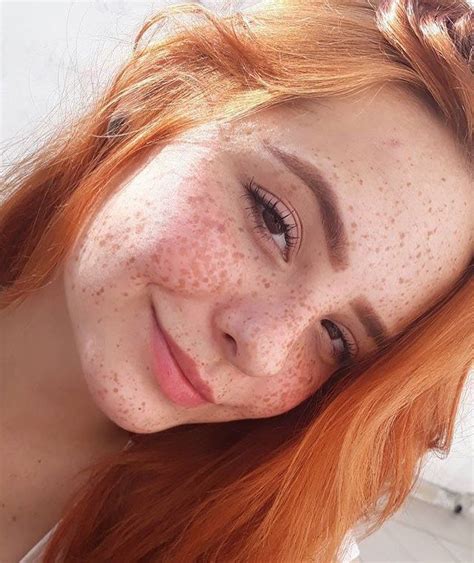 Sexy Girl Freckles Telegraph