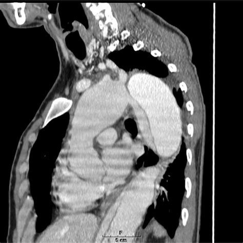 Preoperative Computed Tomography Scan Download Scientific Diagram