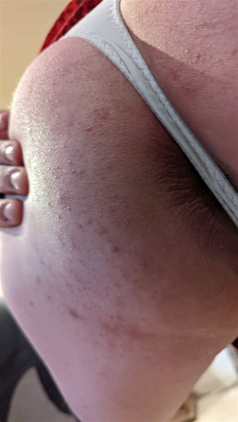 French Travesti In Lingerie Pics XHamster