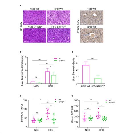 Sting Deficiency Alleviates Hfd Induced Steatohepatitis And Liver