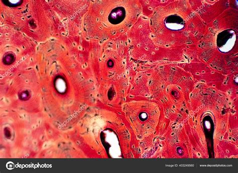 Bone Connective Tissue Under Microscope