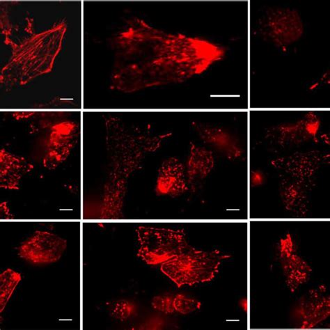 Confocal Images Indicating The Effect Of Various Lipoplex Formulations