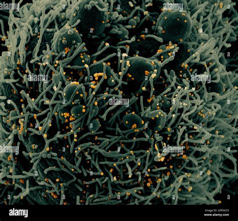 Colorized Scanning Electron Micrograph Of An Apoptotic Cell Green