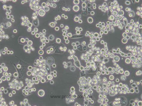 Mda Mb 453 人乳腺癌细胞 Str鉴定正确 武汉普诺赛生命科技有限公司 您身边的细胞专家【官方网站】