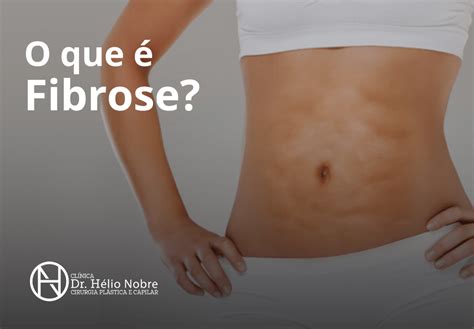 O Que é Fibrose Dr Hélio Nobre