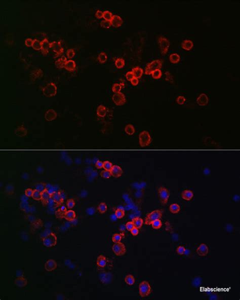 High Affinity And Specificity Ccr Polyclonal Antibody E Ab At