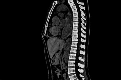 Computer Tomography Angiography Cta Of Whole Body Scan With 3d Reconstruction Ct Angiography For