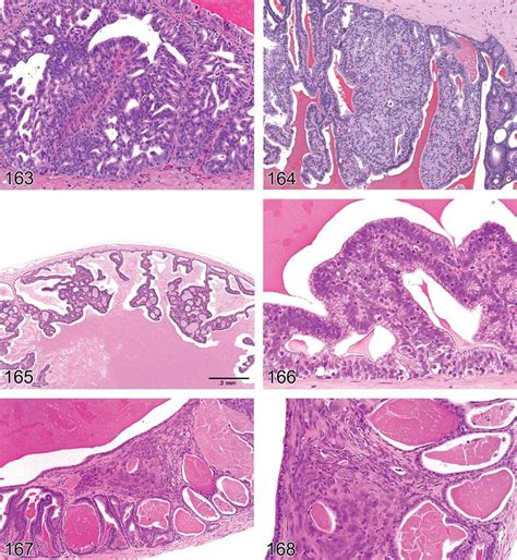 Rat Seminal Vesicles Hyperplasia Atypical Figure 164 Rat Seminal