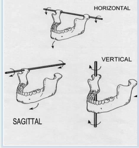 Occlusion 5 Mandibular Movements Flashcards Quizlet