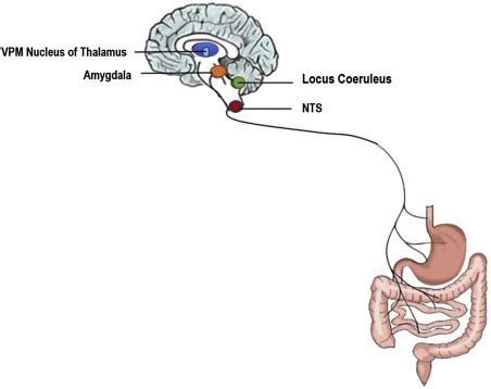 Visceral Pain: Mechanisms, Syndromes, and Treatment | Anesthesia Key