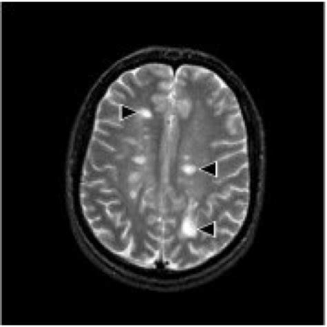 Bildgebung In Der Neurowissenschaft Lexikon Der Neurowissenschaft