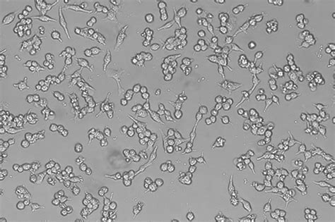 小鼠单核巨噬细胞白血病细胞 Raw2647大连怡然铭钰生物科技有限公司