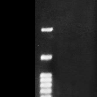 RFLP Pattern For Invasive Bivalves Lane 1 100 Bp Plus DNA Ladder RTU