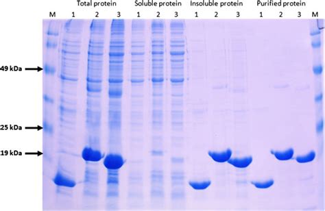 Sds Page Analysis Of Recombinant Protein Expression In E Coli