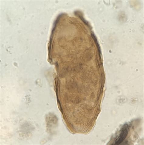 Lab Exam Protozoa Id From Slides Complete Flashcards Quizlet