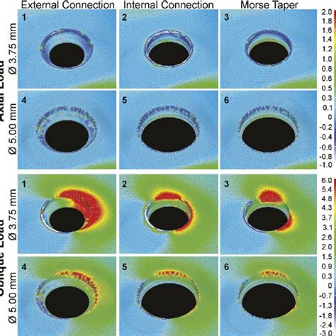 Maximum Principal Stress Values Under Cortical Bone In The Models Under