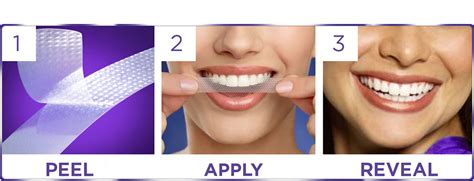 Do Crest Teeth Whitening Strips Work - TeethWalls