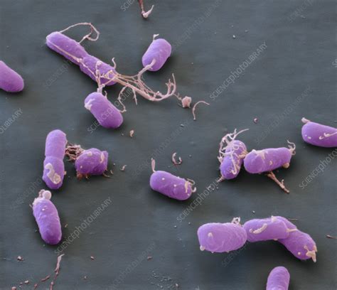 Plague bacteria, Yersinia pestis, SEM - Stock Image - C009/0892 ...