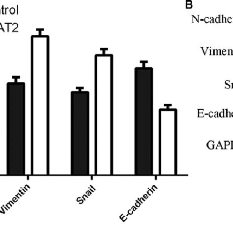 Colon Cancer Associated Transcript 2 CCAT2 Overexpression Increased