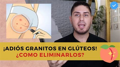 Te Explico Como Deshacerte De Los Granitos En Los Glúteos Foliculitis