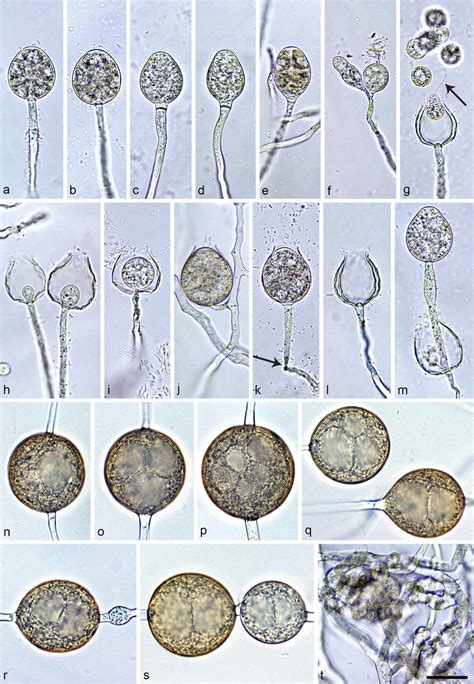 Morphological Structures Of Phytophthora Pseudogallica A M Sporangia