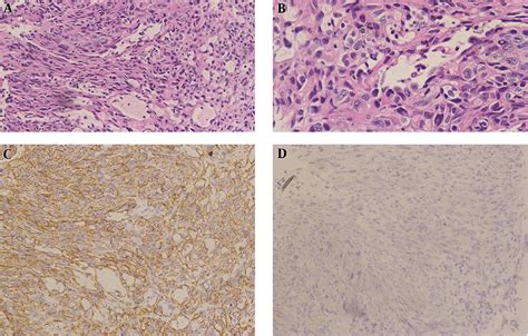 Histological Features And Immunohistochemical Results Of Rectal