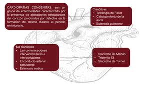 Yermy Presentacion Cardiopatias En MI Pptx Descarga Gratuita