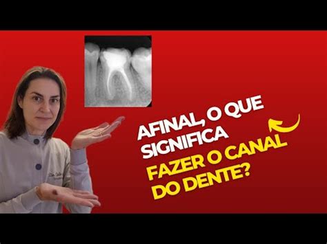 TRATAMENTO DE CANAL o que é tratamento de canal YouTube