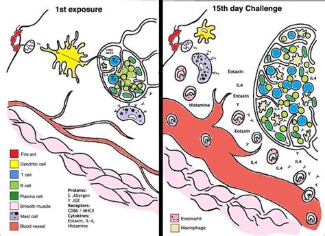 Immunology of Fire Ant Allergy [Nature Paper, technical] : r/Allergies