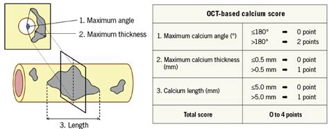 A New Optical Coherence Tomography Based Calcium Scoring System To Predict Stent Underexpansion