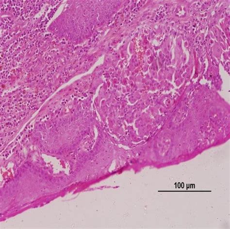 Hyperchromatic Reserve Cells Forming Single Layers At Periphery Of