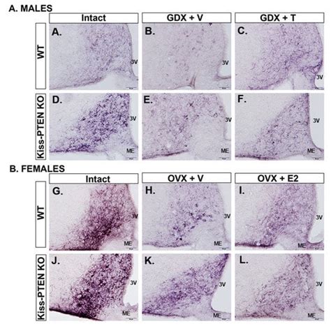 Ijms Free Full Text Targeted Deletion Of Pten In Kisspeptin Cells