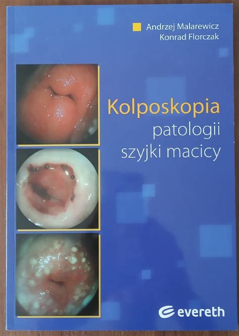 Kolposkopia patologii szyjki macicy A MALAREWICZ Poznań Kup teraz