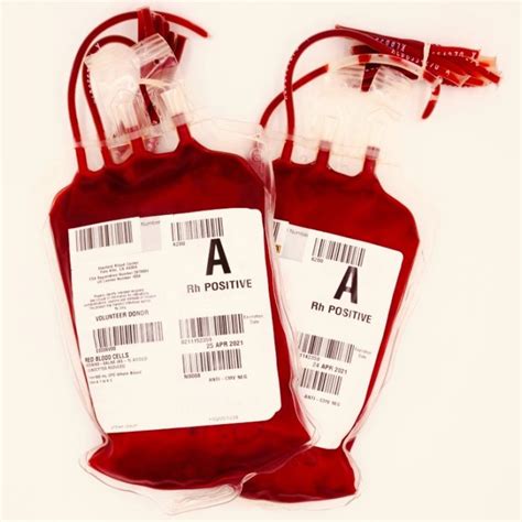 leukapheresis — Stanford Blood Center