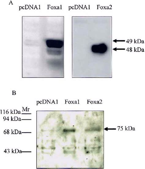 Induction Of Vitronectin Expression By Foxa1 Or Foxa2 Overexpression