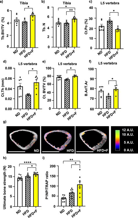 Omega 3 PUFAs Protect Bones From The Detrimental Effect Of HFD In Obese