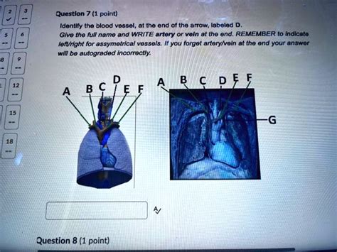 Solved Question Point Identify The Blood Vessel At The End Of The