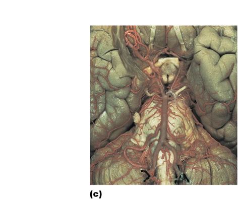 Lesson 5 Arteries Of Head Neck And Brain Diagram Quizlet