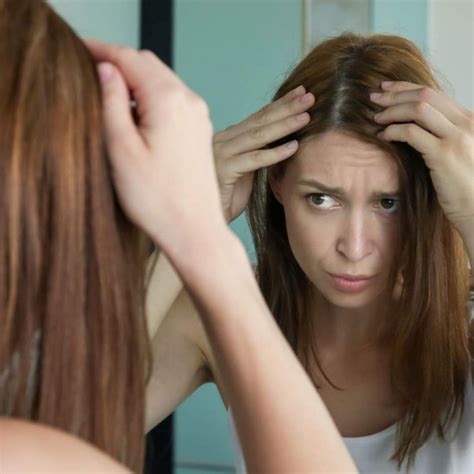 Does Hypothyroidism Cause Hair Loss Addressing The Issue