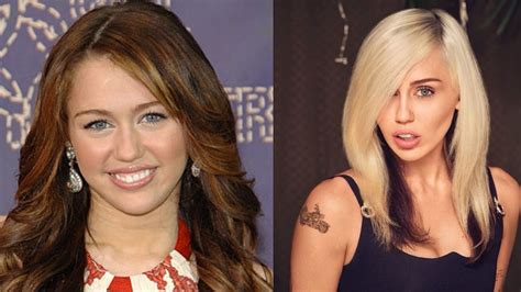 Miley Cyrus The Truth Behind Plastic Surgery Rumors