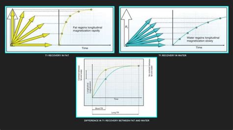 Fat Suppression Techniques In MRI PPT