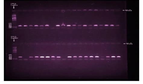 2 Agarose Gel Electrophoresis Analysis Of Pfcrt Mutant Gene Pcrsunder Download Scientific